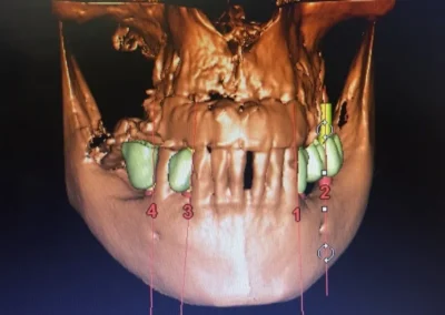 clinica periocell 4